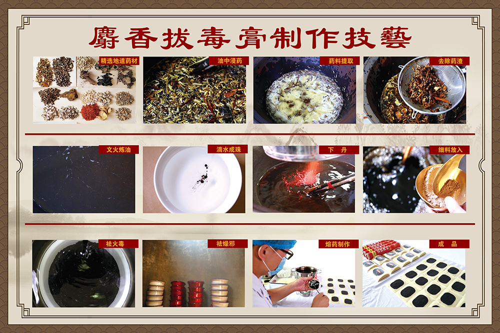 把“非遗名医”请回家：太原市迎泽区中医医院上门服务，让重度褥疮患者重获新生